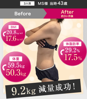 横浜でおすすめのURARAの症例写真